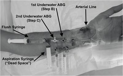 Arterial blood gases in SCUBA divers at depth